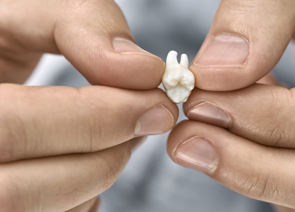 man holding a tooth in his hands