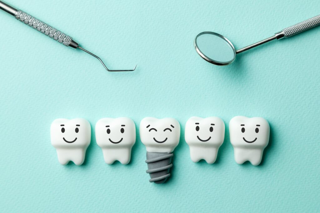 Why Choose Implant-Supported Dentures?