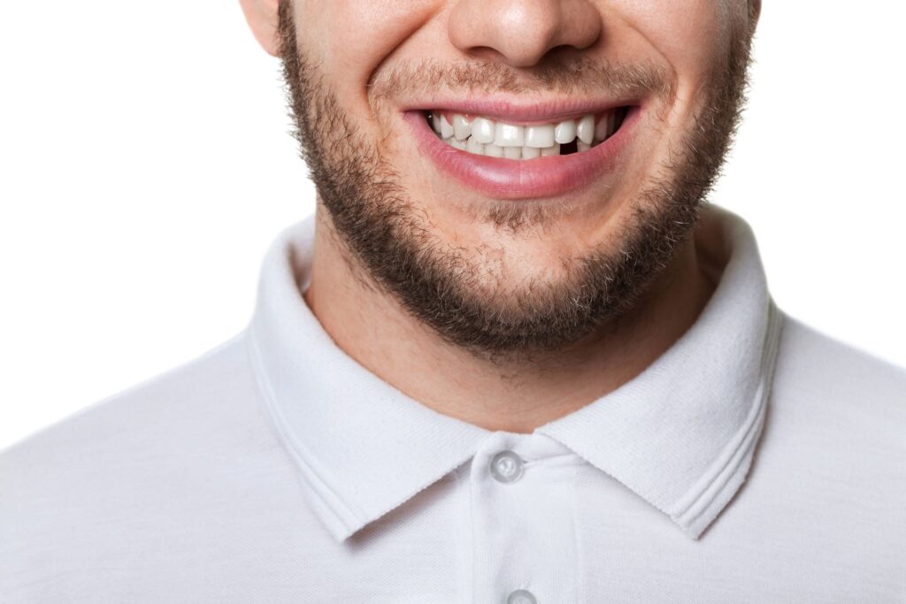 Missing Teeth Causing Social Anxiety? We Can Help!